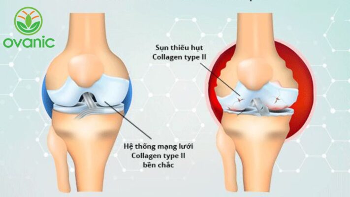 vai trò của collagen trong xương