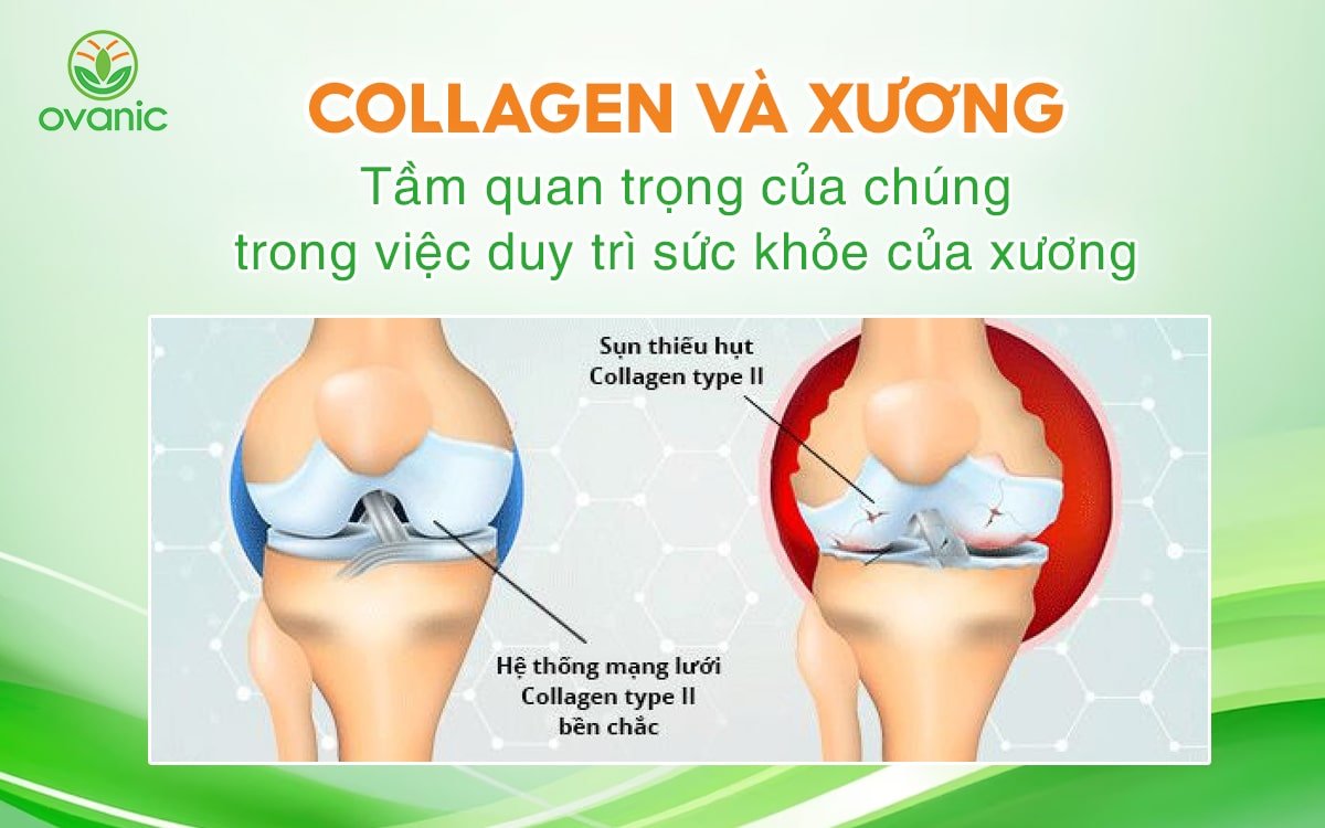 Collagen và xương: Tìm hiểu về tầm quan trọng của Collagen đối với xương