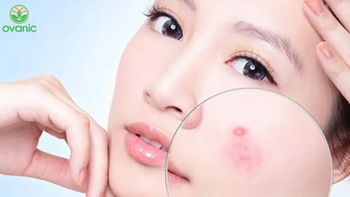 tác dụng phụ khi sử dụng collagen tổng hợp
