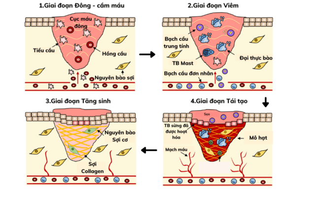 Ảnh minh họa tiến trình lành vết thương