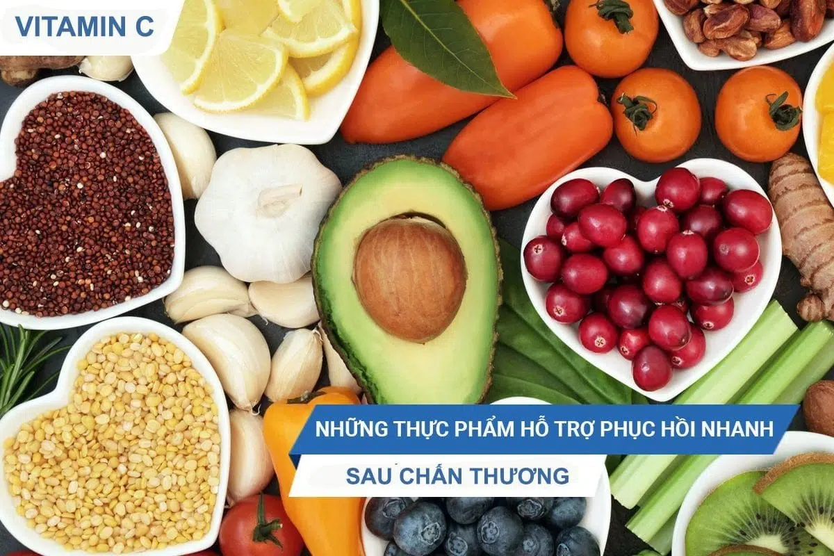 Thực phẩm vitamin C
