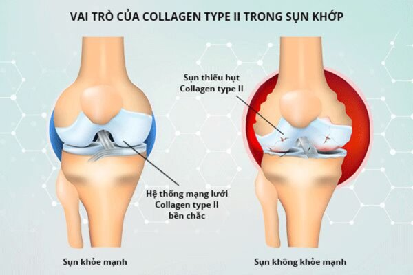 lợi ích collagen với xương khớp