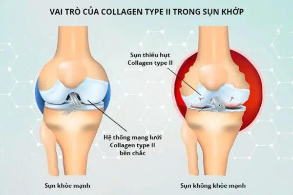 lợi ích collagen với xương khớp