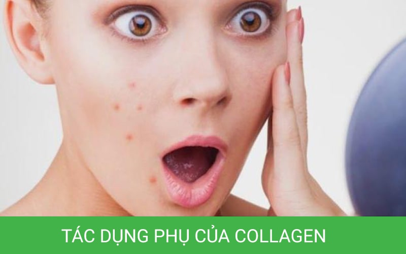 Ảnh minh họa tác dụng phụ của collagen