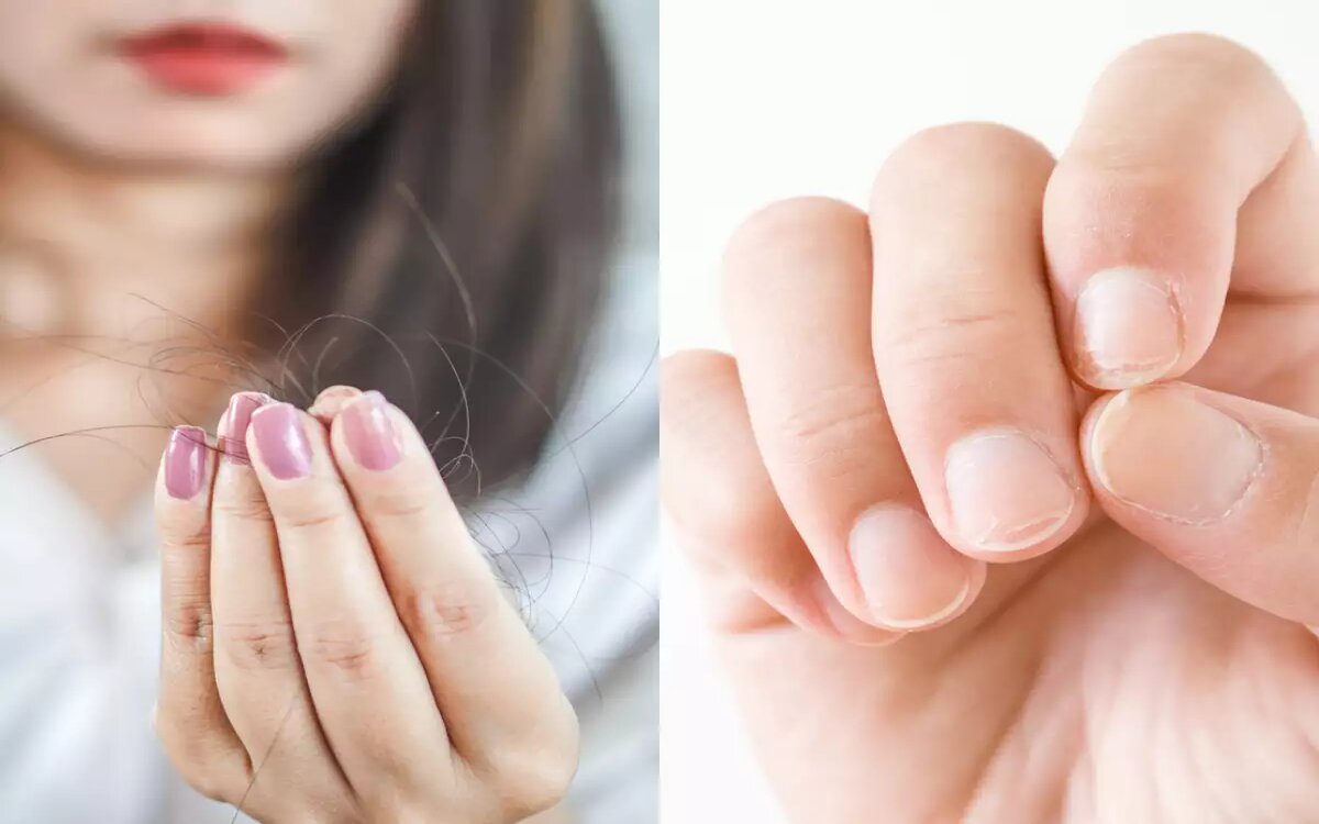 Sức khỏe tóc và móng cũng có thể bị suy yếu