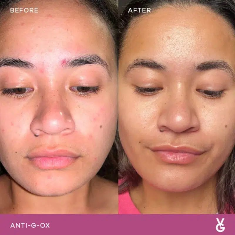 Vida Glow ANTI-G-OX citrus