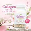 Viên uống collagen