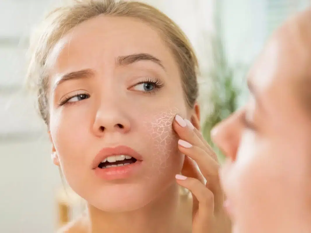 Cấp ẩm da với Innerb Aqua Rich Double Up Làn da khô