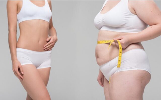 hân hình phì nhiêu, mất cân đối khiến nhiều chị em phụ nữ mất tự tin