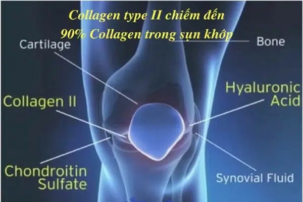 Hỗ trợ sức khoẻ xương khớp