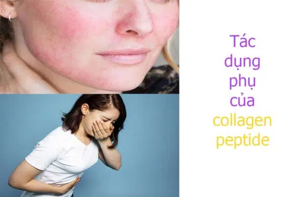 Tác dụng phụ của collagen peptide
